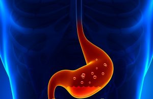 അസിഡിറ്റിയെ തടയാം…