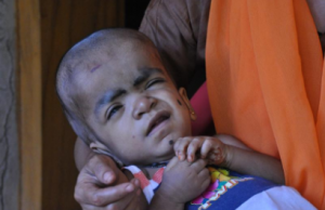 എൻഡോസൾഫാൻ ദുരിതബാധിതർക്ക് ഒാണത്തിന് 1,000 രൂപ ധനസഹായം