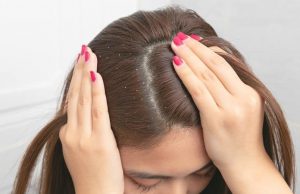 എല്ലാ താരനും ഒന്നല്ല, നിങ്ങളുടെ പ്രശ്നം ഏതെന്ന് കണ്ടെത്തൂ