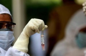 സംസ്ഥാനത്ത് കോവിഡ് പരിശോധനകള്ക്കുള്ള നിരക്ക് കുറച്ചു