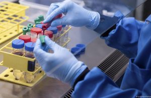 ഉമിനീരില് നിന്ന് ഒരു മണിക്കൂറിനുള്ളില് കോവിഡ് ബാധയറിയാം; പുതിയ കണ്ടുപിടുത്തവുമായി ഗവേഷകര്