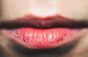 മഞ്ഞുകാലം വരവായി; ചുണ്ട് വരണ്ട് പൊട്ടുന്നത് എളുപ്പം പരിഹരിക്കാം