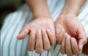 നഖത്തിന്റെ അടിയില് നിറവ്യത്യാസമുണ്ടോ? ചിലപ്പോള് കോവിഡ് ആകാം, ലക്ഷണങ്ങള് പലവിധം