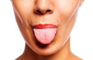 വൈറ്റമിന് ഡി കുറവാണോ?; ആദ്യ സൂചന തരുന്നത് നമ്മുടെ നാക്ക്