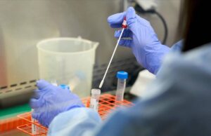 കോവിഡ് ഗുരുതരമാകാതിരിക്കാന് ആര്ത്രൈറ്റിസ് മരുന്നും; ഡബ്ല്യൂഎച്ച്ഒ അംഗീകാരം നല്കി