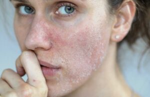 വരണ്ട ചര്മ്മമാണോ നിങ്ങളുടേത്?; എങ്കില് ഇക്കാര്യങ്ങള് ശ്രദ്ധിക്കണം