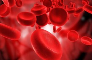 ബ്ലഡ് പ്രോട്ടീൻ കുറവ് നിസ്സാരമല്ല. അറിയാം കാരണങ്ങളും ലക്ഷണങ്ങളും