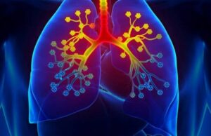 കോവിഡ് മുക്തിക്ക് ശേഷം ആസ്തമയും ക്ഷയവും വർദ്ധിക്കുന്നു