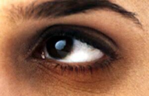 കണ്തടങ്ങളിലെ കറുപ്പ് പരിഹാരങ്ങൾ